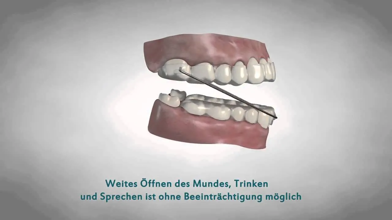 Vorschaubild: Schnarcher-Schiene BonDorm – Trailer (Video mit KI-Bildszenen)